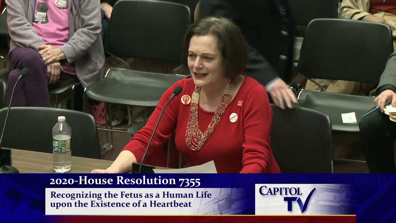 2020-02-25 Fetal Heartbeat Resolution 02