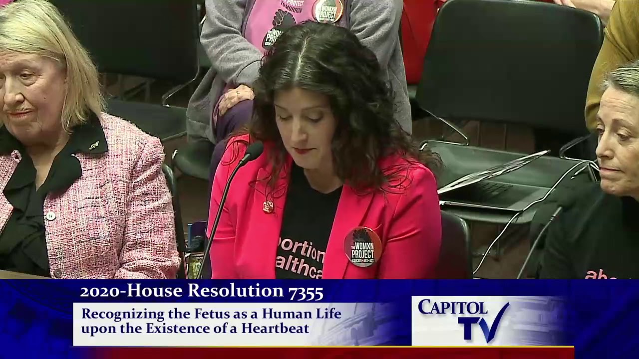2020-02-25 Fetal Heartbeat Resolution 04