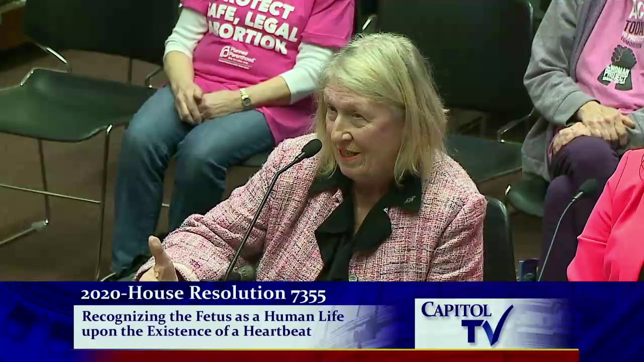 2020-02-25 Fetal Heartbeat Resolution 05