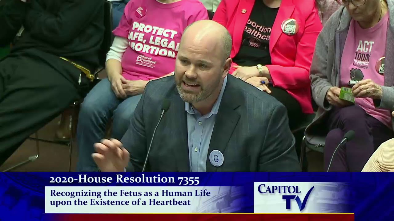 2020-02-25 Fetal Heartbeat Resolution 06