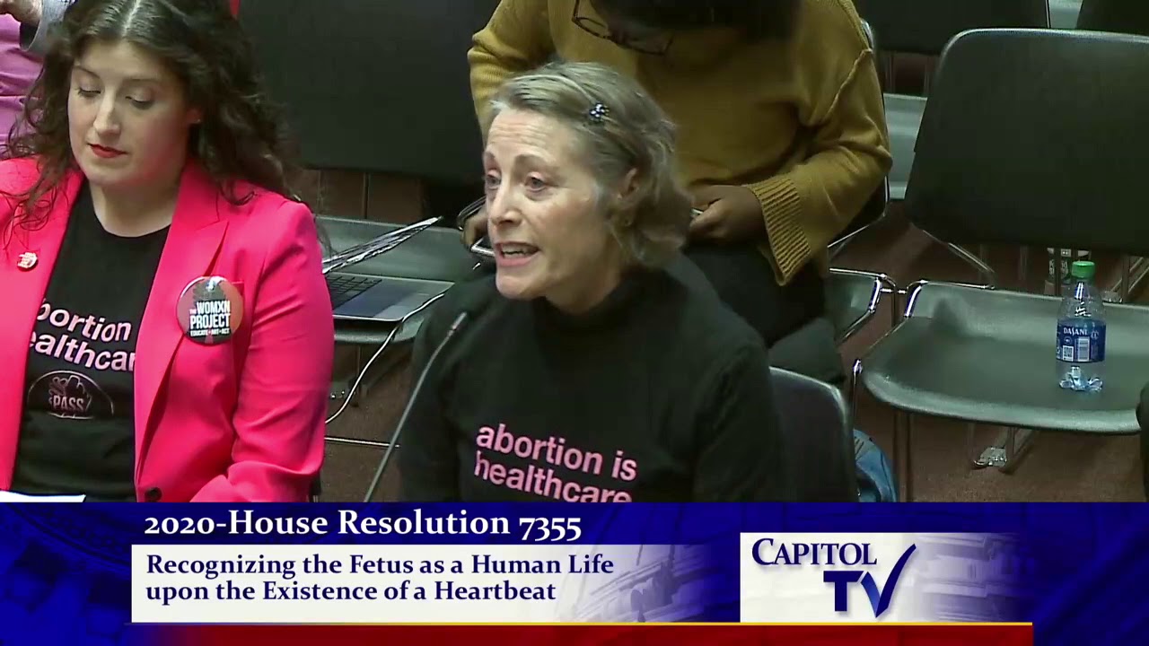 2020-02-25 Fetal Heartbeat Resolution 03